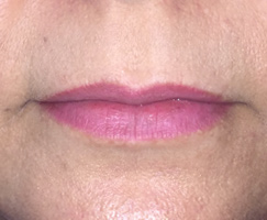 Permanent Lips by Artistry Of Permanent Makeup of Orange County