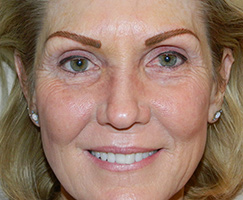 Permanent Makeup Corrective Work by Artistry Of Permanent Makeup of Orange County