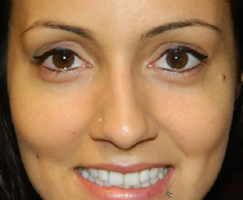 Permanent Eyeliner by Artistry Of Permanent Makeup of Orange County