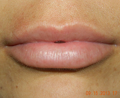 Permanent Lips by Artistry Of Permanent Makeup of Orange County